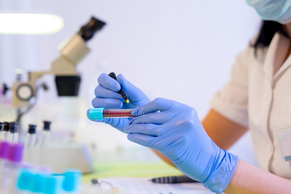 Woman working in a laboratory. He writes with a felt pen. Selective focus