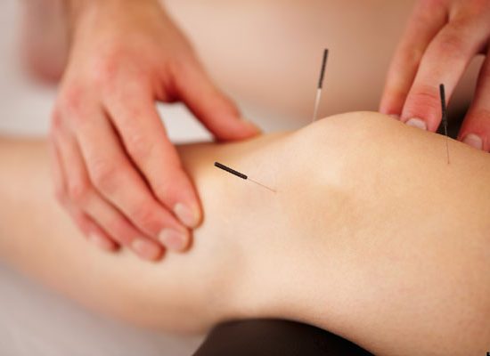 Needling