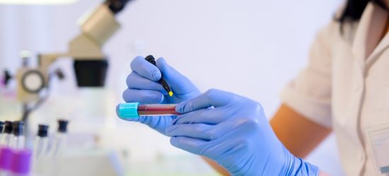 Woman working in a laboratory. He writes with a felt pen. Selective focus