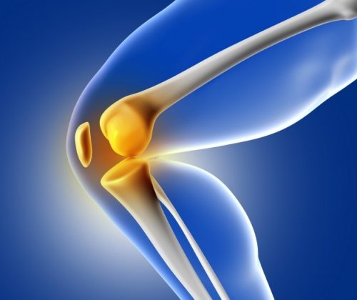 ACL Injury Physiotherapy  Ligament tear Physiotherapy - WTC TODAY